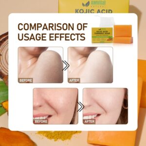 AMVital Kojic Acid Soap for Dark Spots, Turmeric Soap for Face & Body with Hyaluronic Acid, Vitamin C, Vitamin E, Shea Butter, Castile Olive Oil (2 Pack) - Image 5
