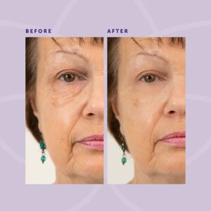Eye Creams for Anti-Aging - 5 Seconds Instant Effect, Anti Aging Fade Wrinkle Fast Absorption Expertise Wrinkle Remover Cream Face Essence Cream, 1oz - Image 5