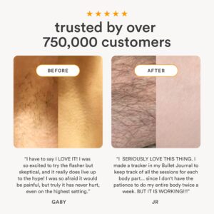 Nood Flasher 2.0 — IPL Laser Hair Removal Device for Women & Men — Pain-Free & Permanent Results - Image 4