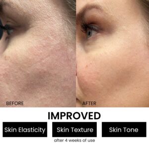 Kleem Organics Collagen Peptide Firming Serum – Anti-Aging, Hydrating, All Skin Types - Image 5