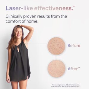 Braun IPL Skin I·expert, at Home Hair Removal, with Free App, Vanity Case, Venus Razor, 4 Smart Heads, Alternative for Laser Hair Removal, PL7387 - Image 5