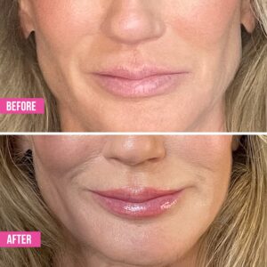 Vibriance Hydrating Lip Volumizer - Plumping Gloss with Hyaluronic Acid - Plumper Smooths Lines and Wrinkles, 0.14 fl oz - Image 4