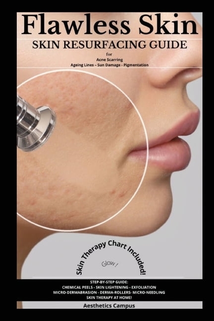 Flawless Skin: Skin Resurfacing Guide for Acne Scarring – Ageing Lines – Sun Damage – Pigmentation (Paperback)