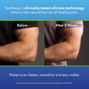 ScarAway Advanced Silicone Scar Sheets, Medical Grade Variety Pack, 8 Reuseable Sheets - Image 9