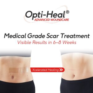 Neo G Opti-Heal Silicone Wound Recovery Strips, 6CT - Image 4