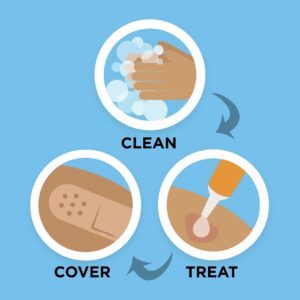 Band-Aid Brand Hurt-Free Self-Adherent Wound Wrap, 2 In by 2.3 yd - Image 5