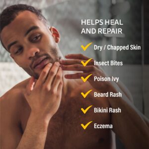 A+D Medicated Rash Ointment 1.5 oz – Relieves Rash & Skin Irritated Skin - Image 8